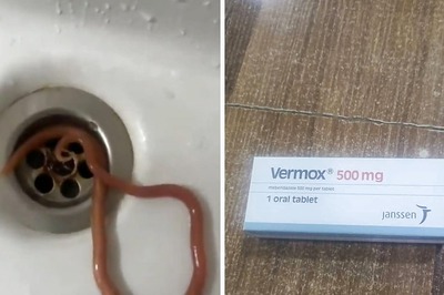 Man, Suffering From Abdominal Pain, Vomits Live Worm After Complaining Of Nausea